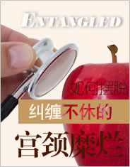 微创治疗子宫肌瘤新概念
